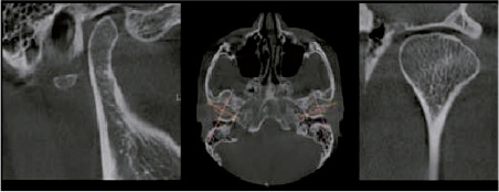 Escáner maxilofacial 3D con campo de visión 8x15 centímetros