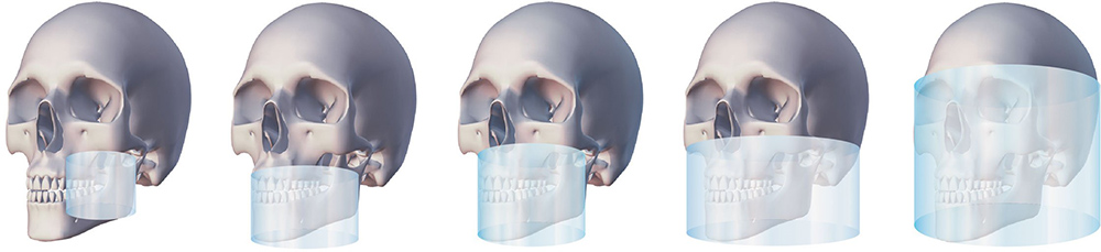 Escáner maxilofacial 3D con diferentes tamaños de campo de visión