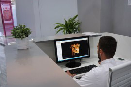 Scanedent 3D Almería