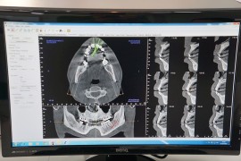 Scanedent 3D Almería